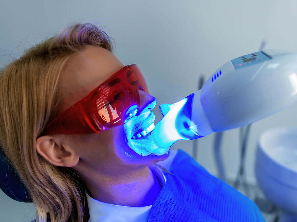 Teeth Whitening