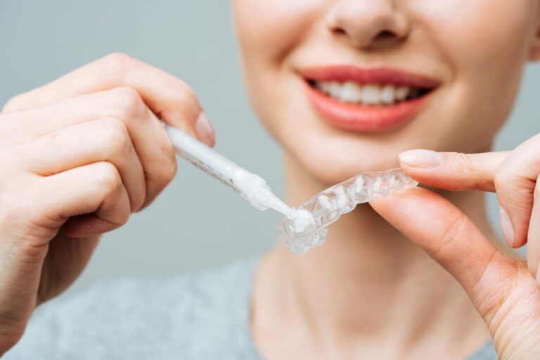 Woman using at home teeth whitening procedure with whitening tray with gel